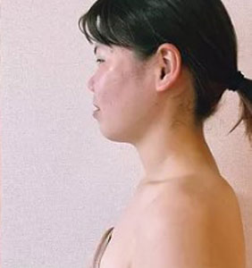 施術後の女性